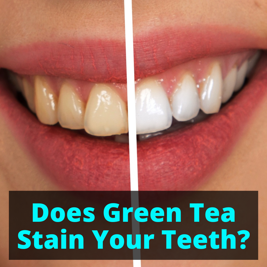 Green Tea Teeth Care: Stain Prevention Guide