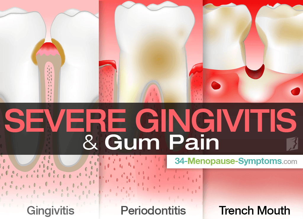 Gum Pain With Cold