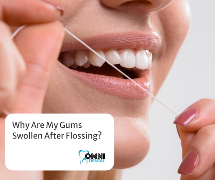 Gum Swollen After Flossing