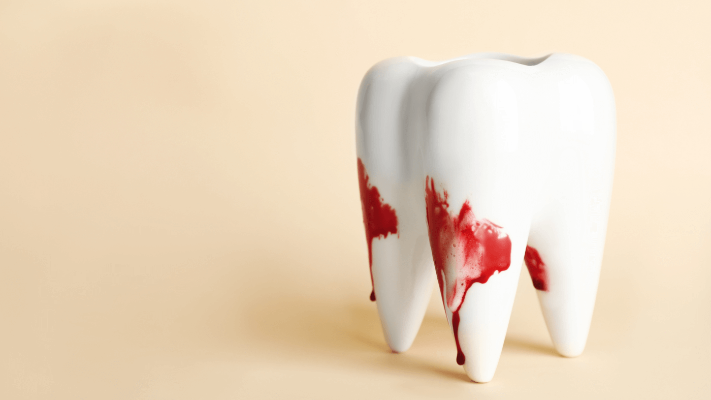 Gums Bleeding While Flossing