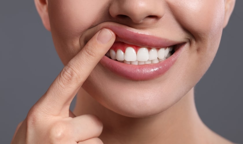 Gums Puffy After Flossing: Causes Revealed