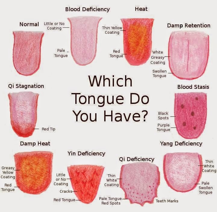 Help A Burnt Tongue