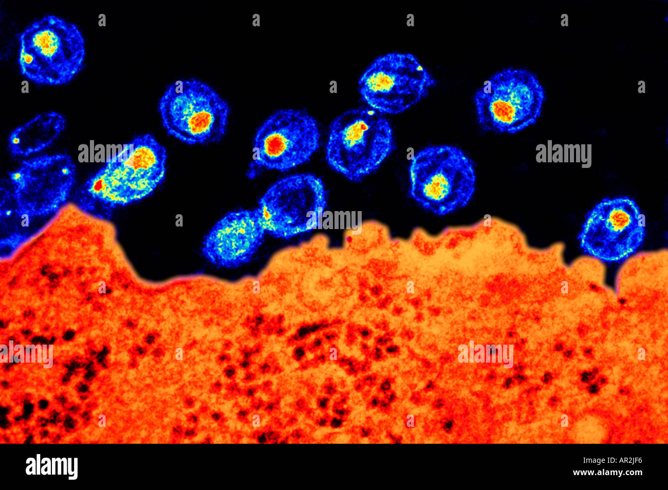 Hiv Electron Microscope Images Explained