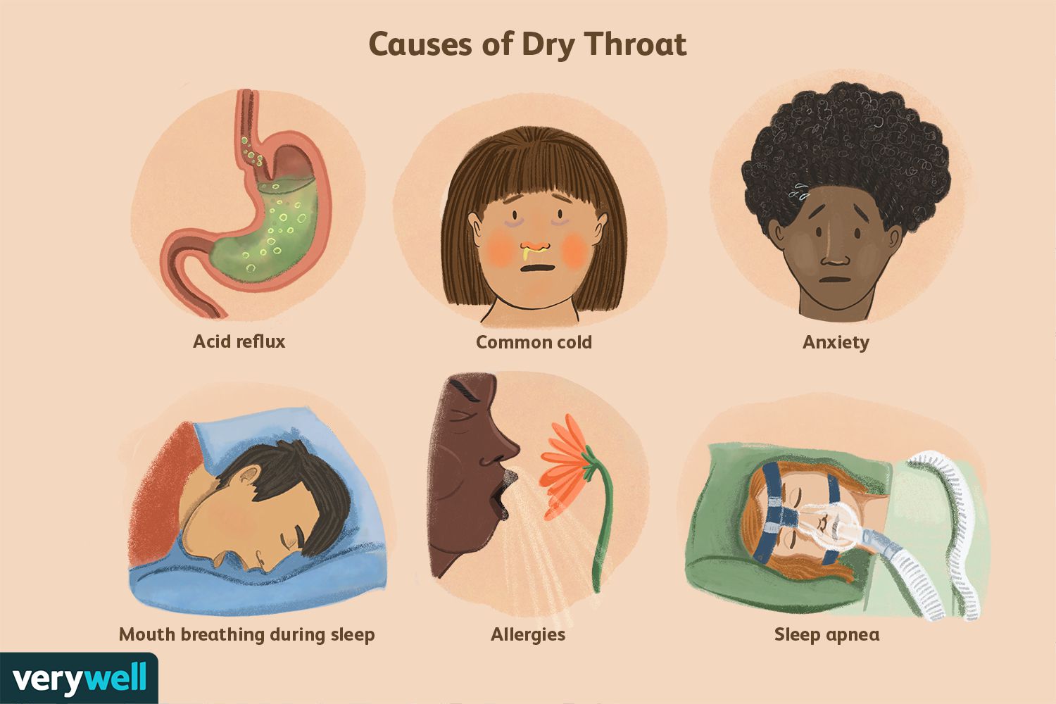 How Do Allergies Lead To Dry Throat? Solutions Inside