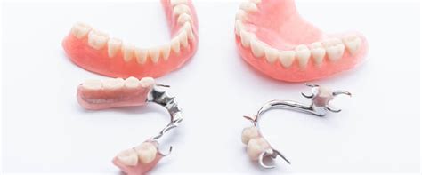 How Do Snap On Dentures Work? Easy Placement Guide
