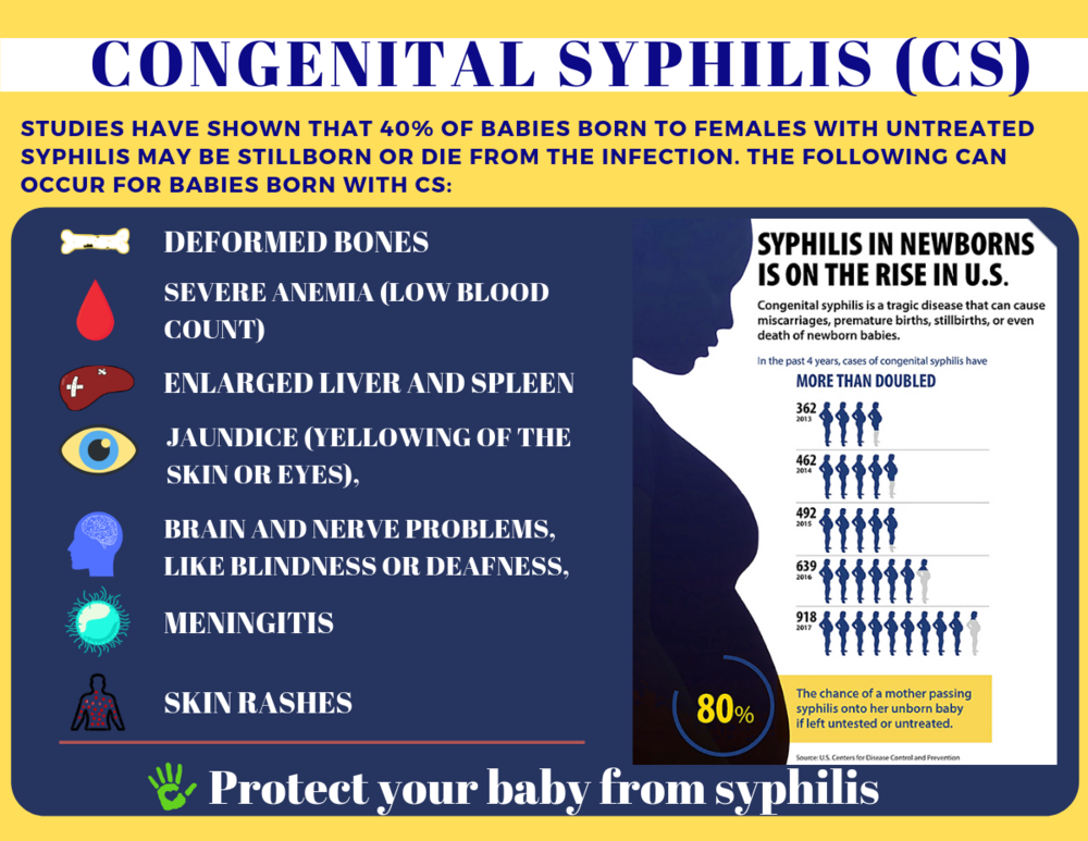 How Is Congenital Syphilis Treated? Find A Cure