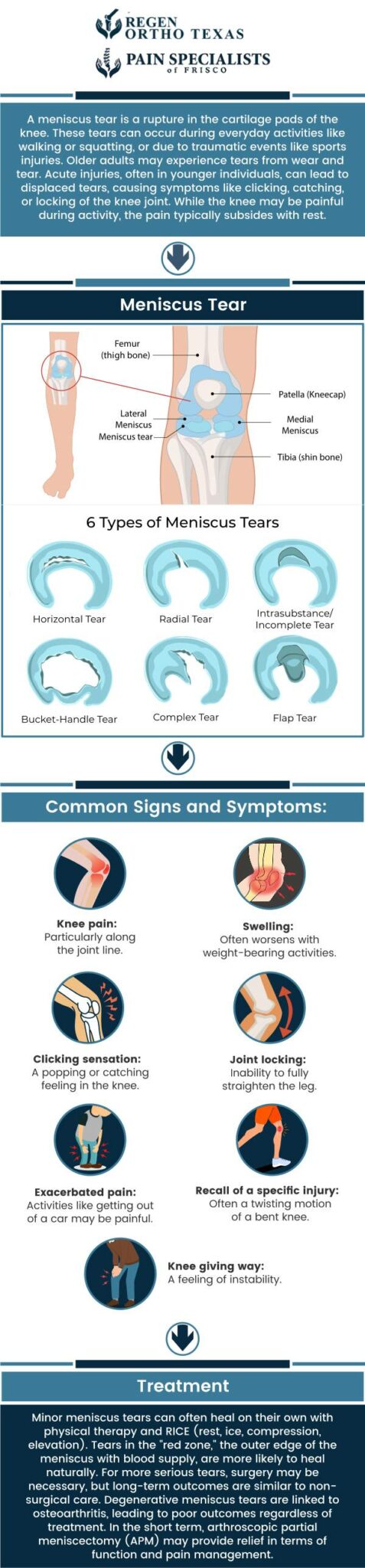 How Long Does Meniscus Pain Last? Postop Solutions How Long Does Meniscus Pain Last? Postop Solutions