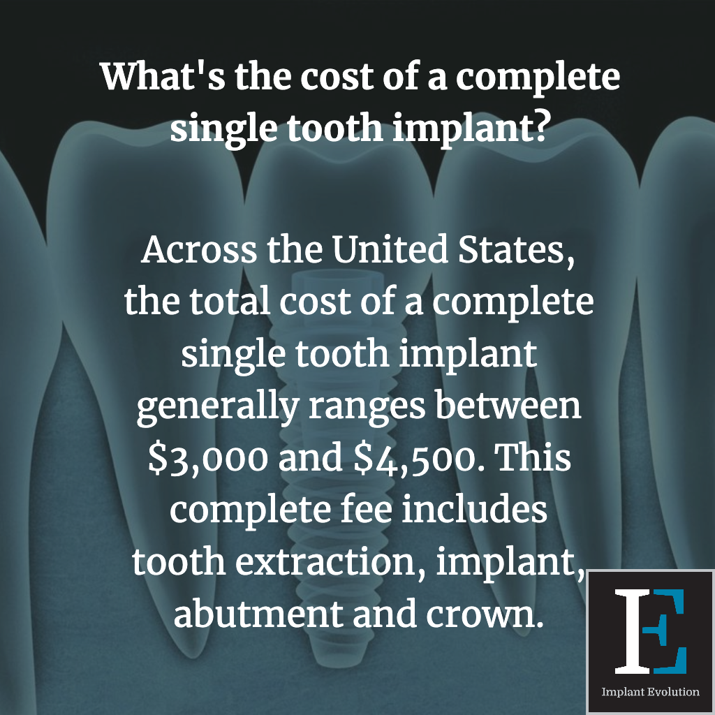 How Much Do Dental Implant Quotes Vary? Find Best Deals