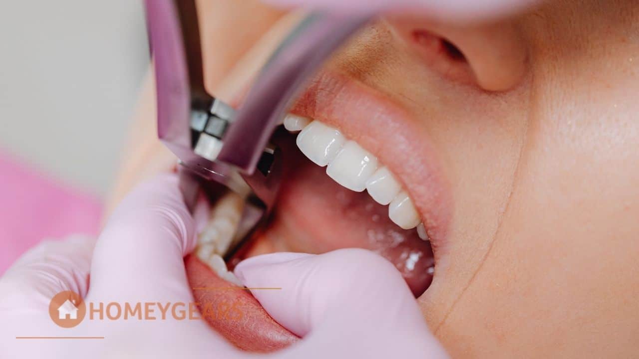 How To Fill Hole On Front Tooth? Easy Solution