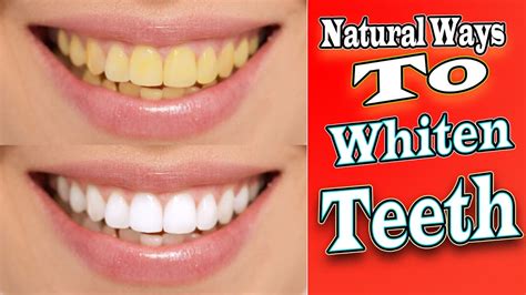 How To Fix Patchy White Teeth? Get Perfect Smile How To Fix Patchy White Teeth? Get Perfect Smile