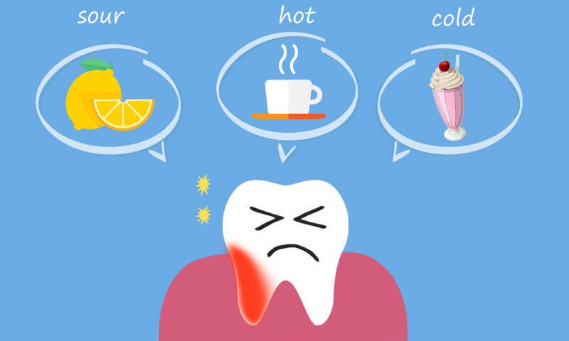 How To Fix Side Of Tooth Filling Sensitivity? Expert Help
