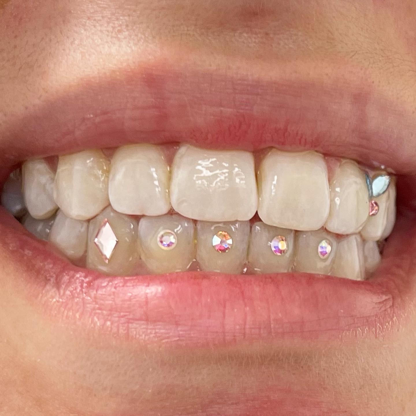 How To Get Tooth Out? Easy Removal Tips