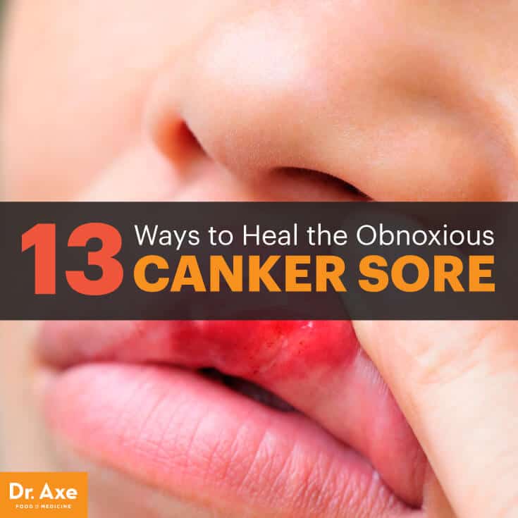 How To Heal Tonsil Canker Sore? Natural Remedies
