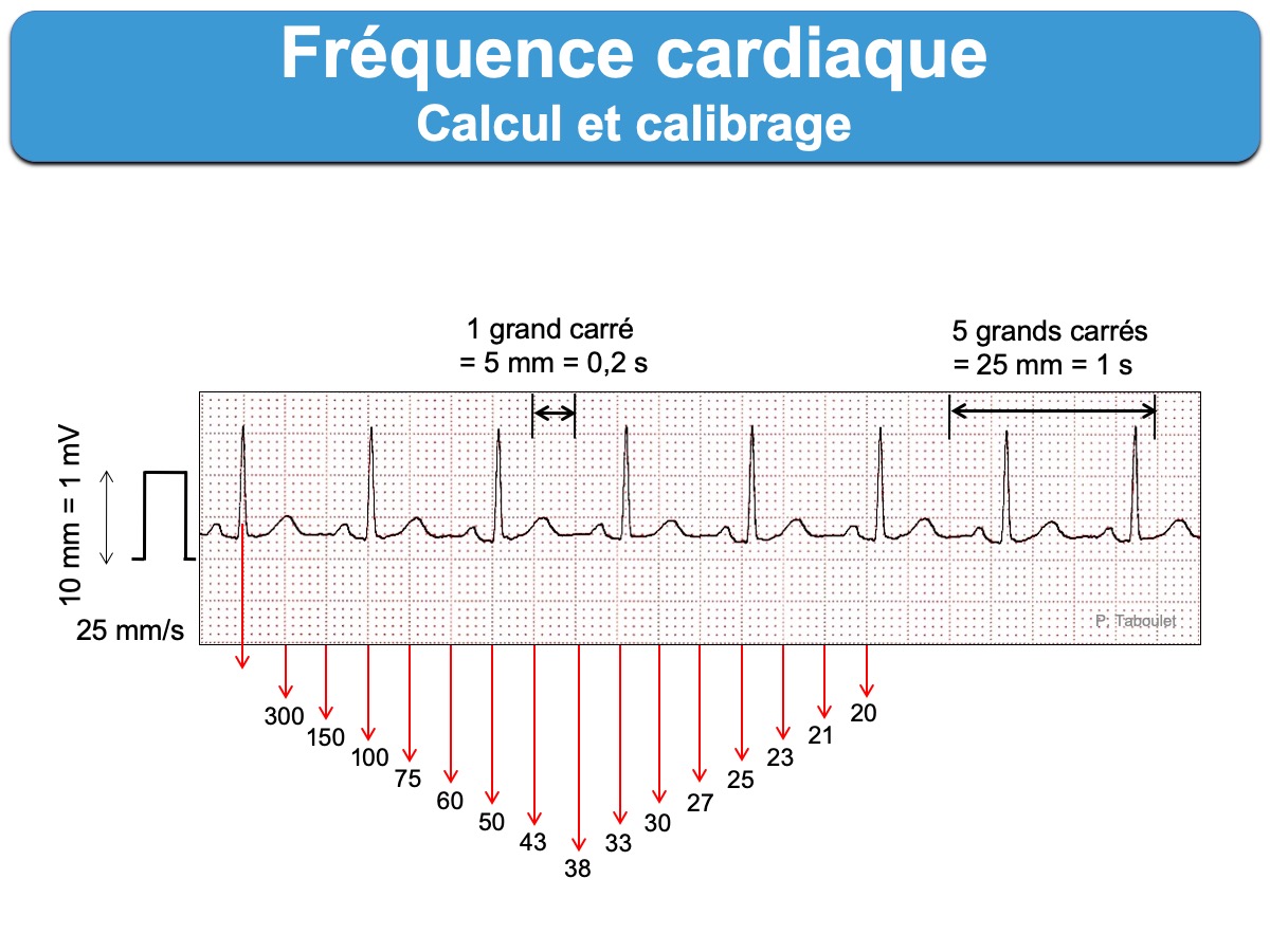 How To Lower Fréquence Cardiaque? Easy Monitoring Tips