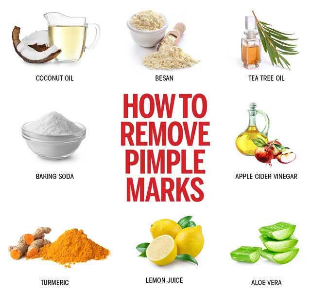 How To Remove Black Pimple On Tongue? Quick Cure How To Remove Black Pimple On Tongue? Quick Cure