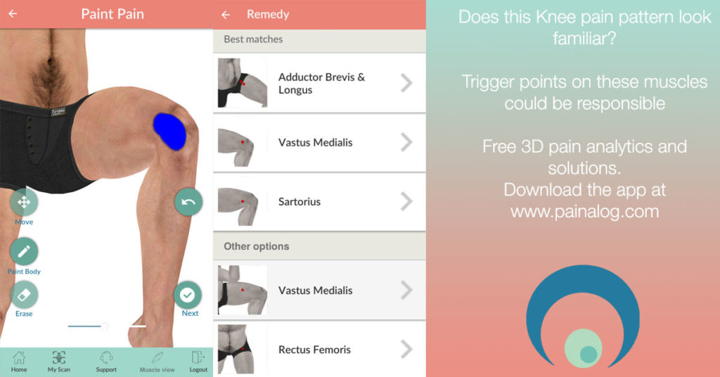 How To Stop Medial Knee Pain When Running? Solutions