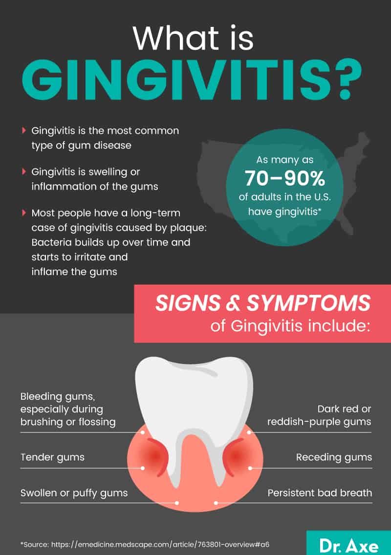 How To Treat Gingivitis? Natural Remedies How To Treat Gingivitis? Natural Remedies