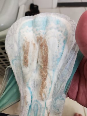 How To Treat Gravidez Corrimento Escuro? Quick Relief How To Treat Gravidez Corrimento Escuro? Quick Relief