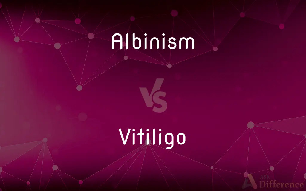 How To Treat Vitiligo Vs Albinism? Effective Solutions How To Treat Vitiligo Vs Albinism? Effective Solutions