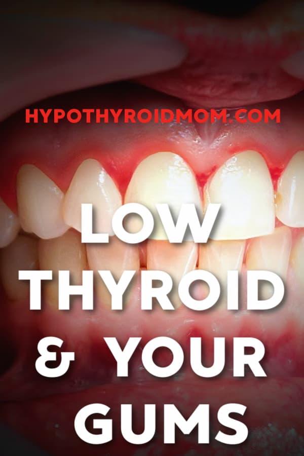 Hypothyroid And Yeast Infections