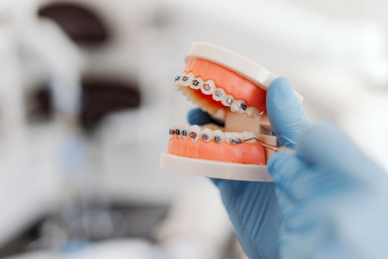 Ideal Age To Get Braces