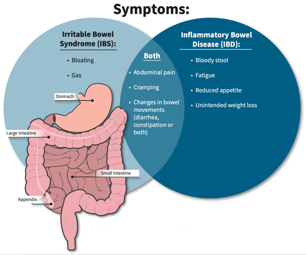 Irritable Bowel Syndrome Night Sweats