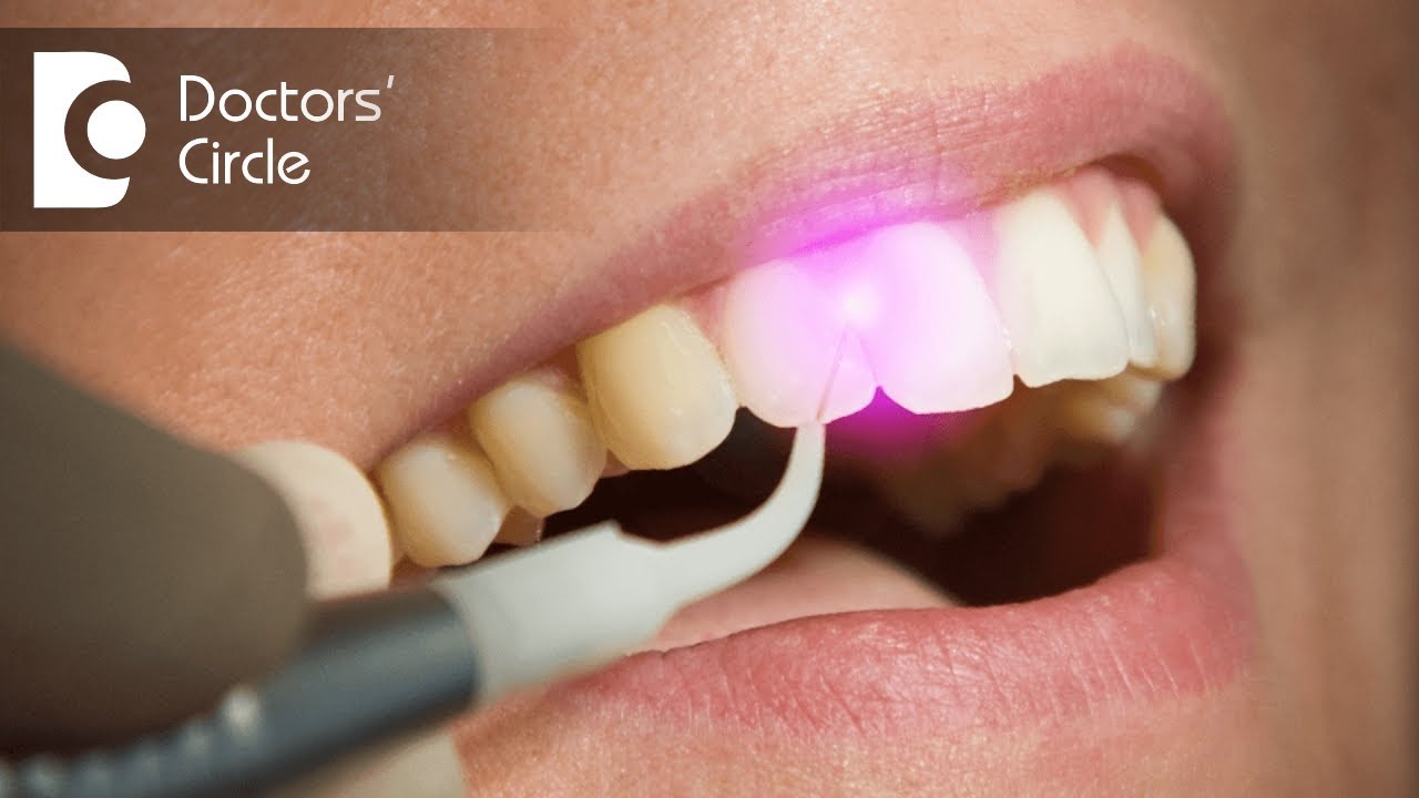 Laser Gum Treatment: Reduce Pain And Inflammation
