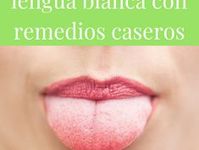 Lengua Blanca Remedios Naturales