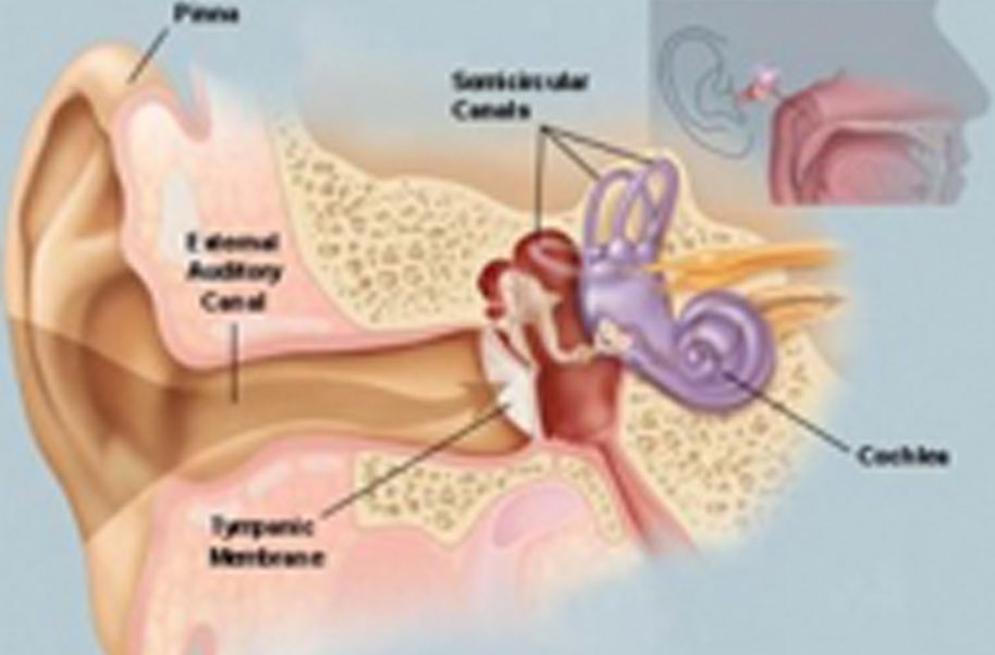Low Tone Deafness