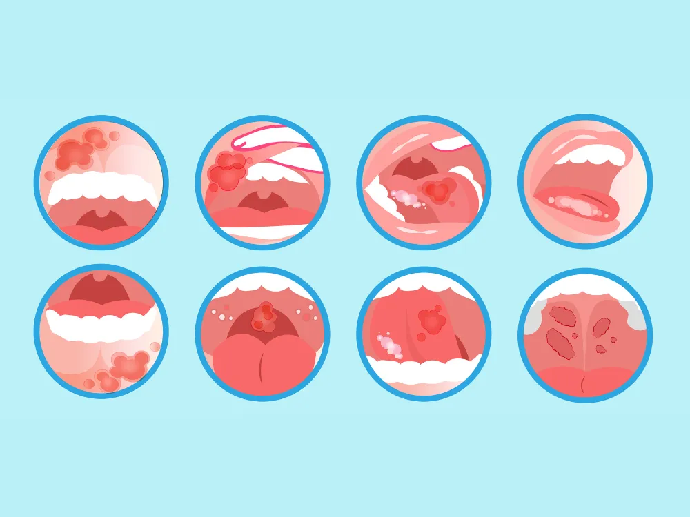 Lump On Child's Gum: Find Fast Relief Solutions