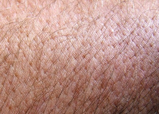 Lung Cancer And Skin Rash