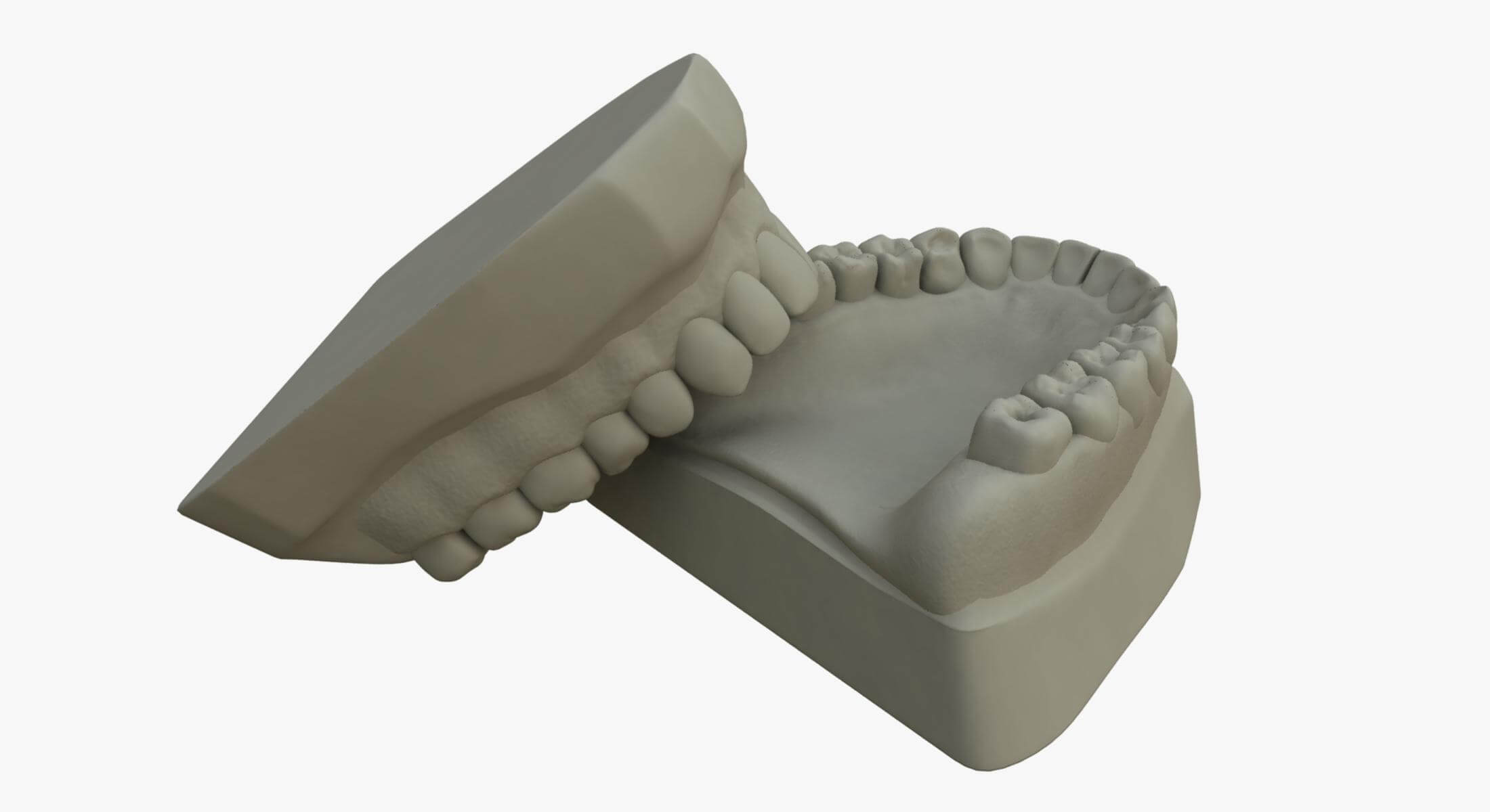 Mold In Teeth