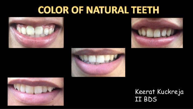 Natural Color Of The Teeth