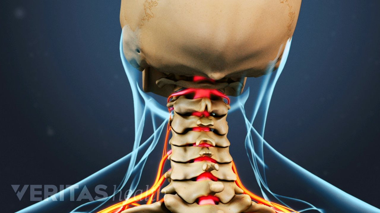 Neck Pops Solved: Causes & Relief