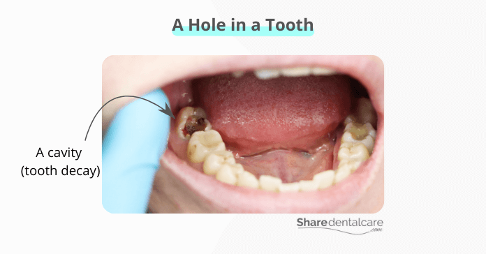 No Cavities: Find Relief For Tooth Pain No Cavities: Find Relief For Tooth Pain