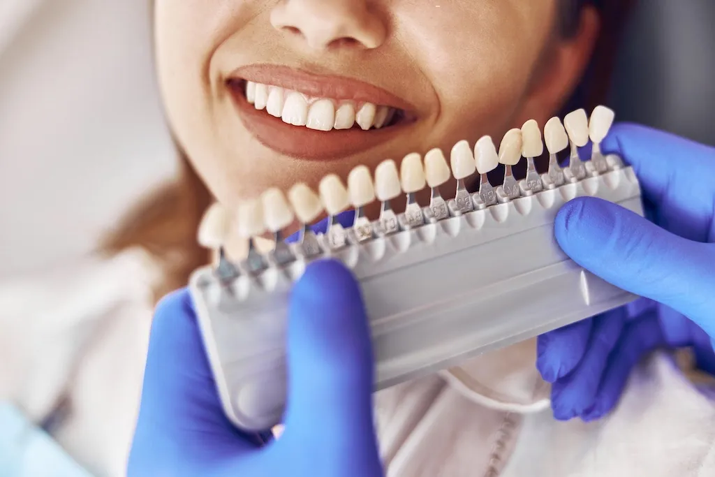 Normal Colour Teeth