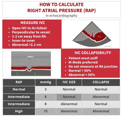 Normal Ra Pressure: Your Comprehensive Guide