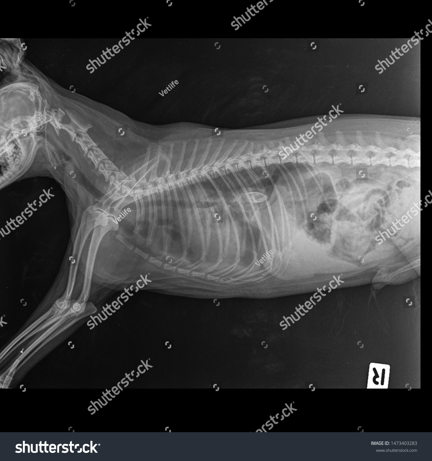 Obstruction Of Esophagus