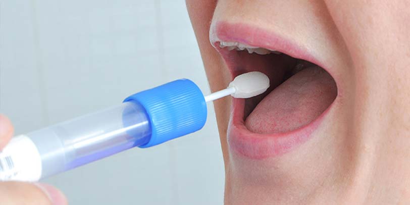Oral Cotton Swab Drug Test