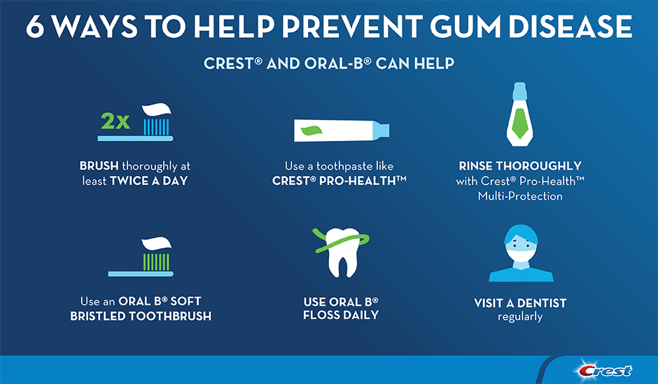 Oral Hygiene: Prevents Cavities With Daily Tips Oral Hygiene: Prevents Cavities With Daily Tips
