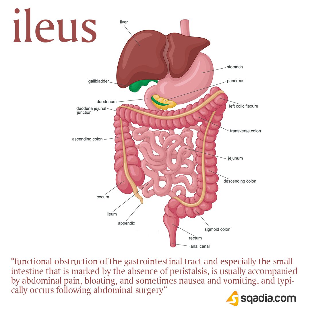 Penetrating Ulcer Symptoms Penetrating Ulcer Symptoms