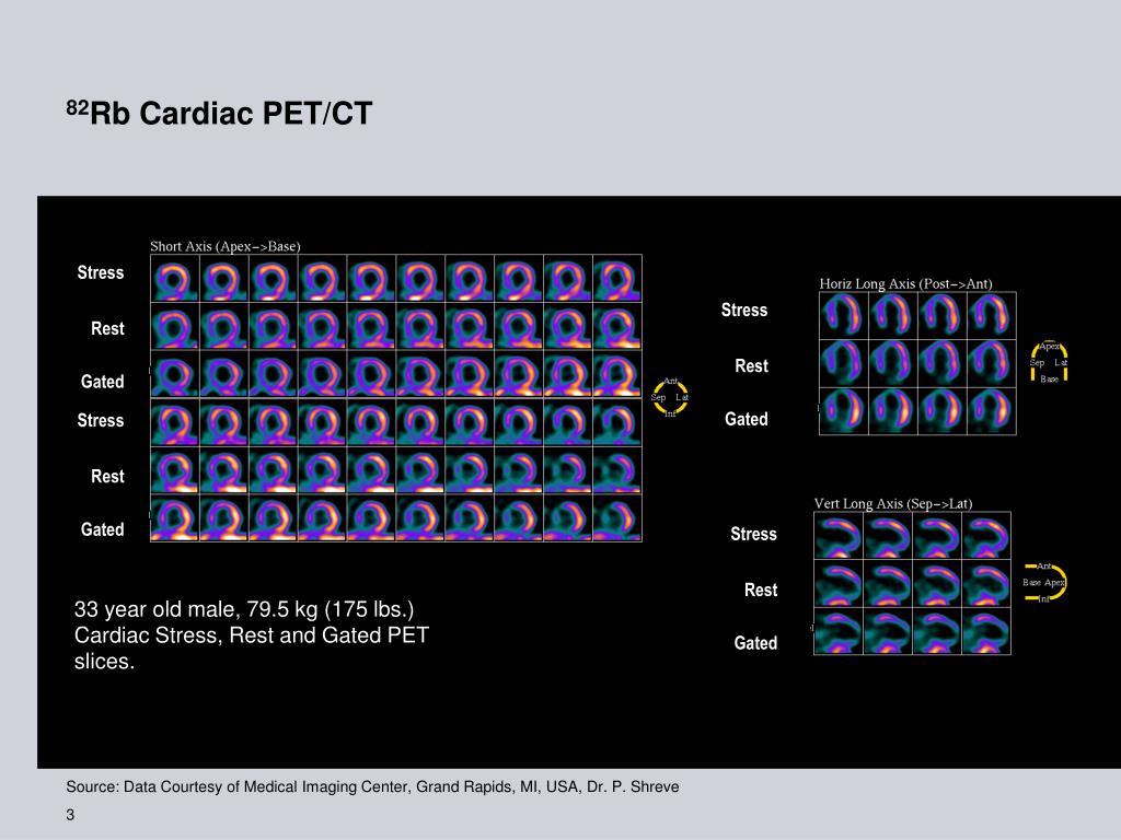 Pet Cardiac Perfusion