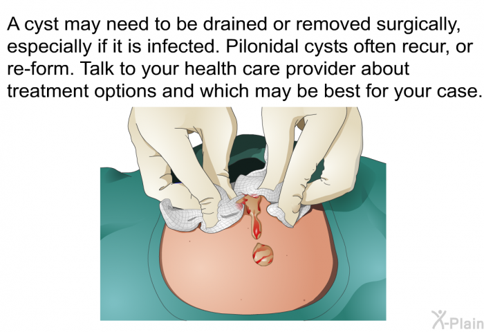 Pilonidal Cyst Wound