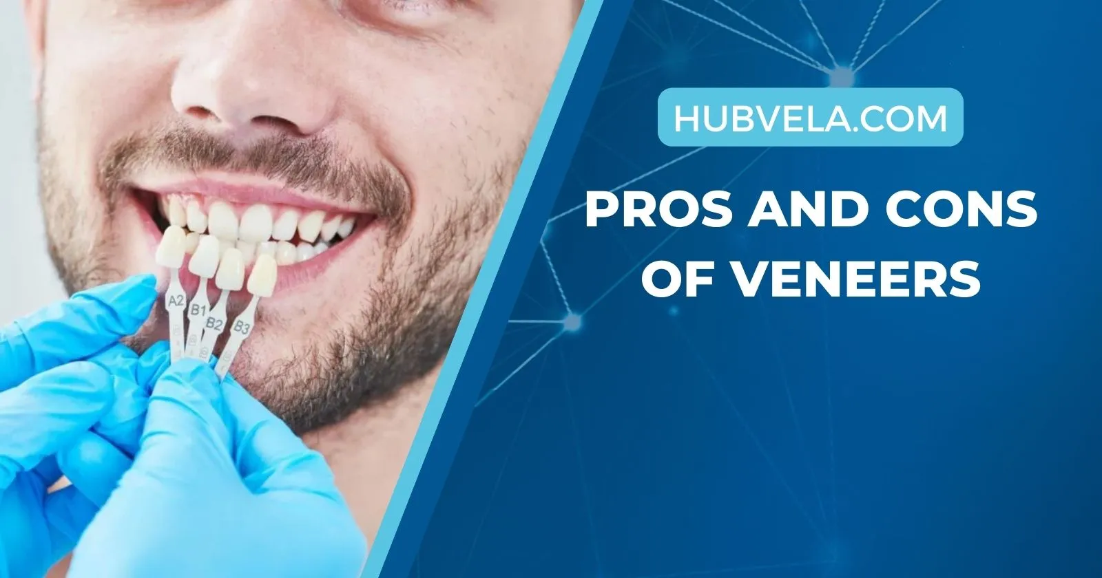 Pros And Cons For Veneers
