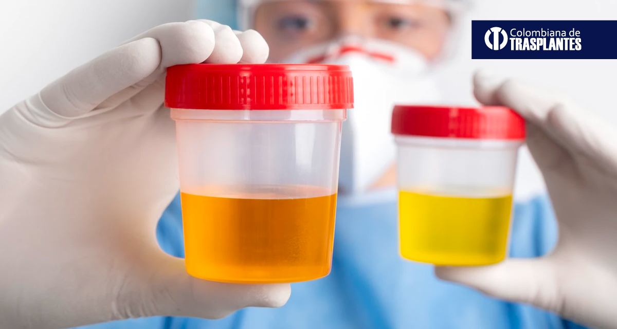 Proteinuria And Hematuria Proteinuria And Hematuria