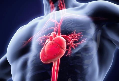Que Es Un Sincope Cardiaco