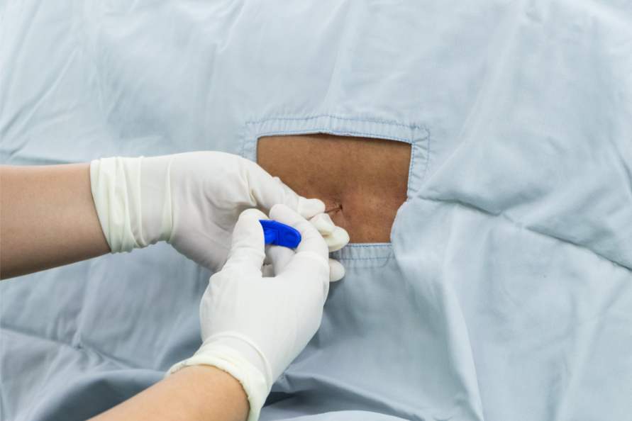 Radial Nerve Block Guide: Simplify Pain Relief