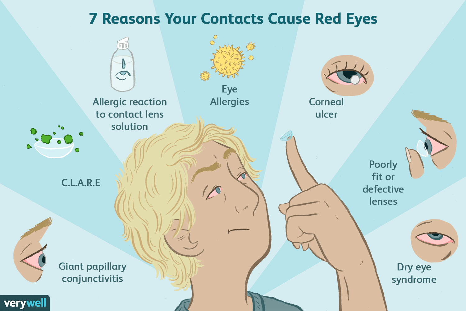Red Eyes After Contacts