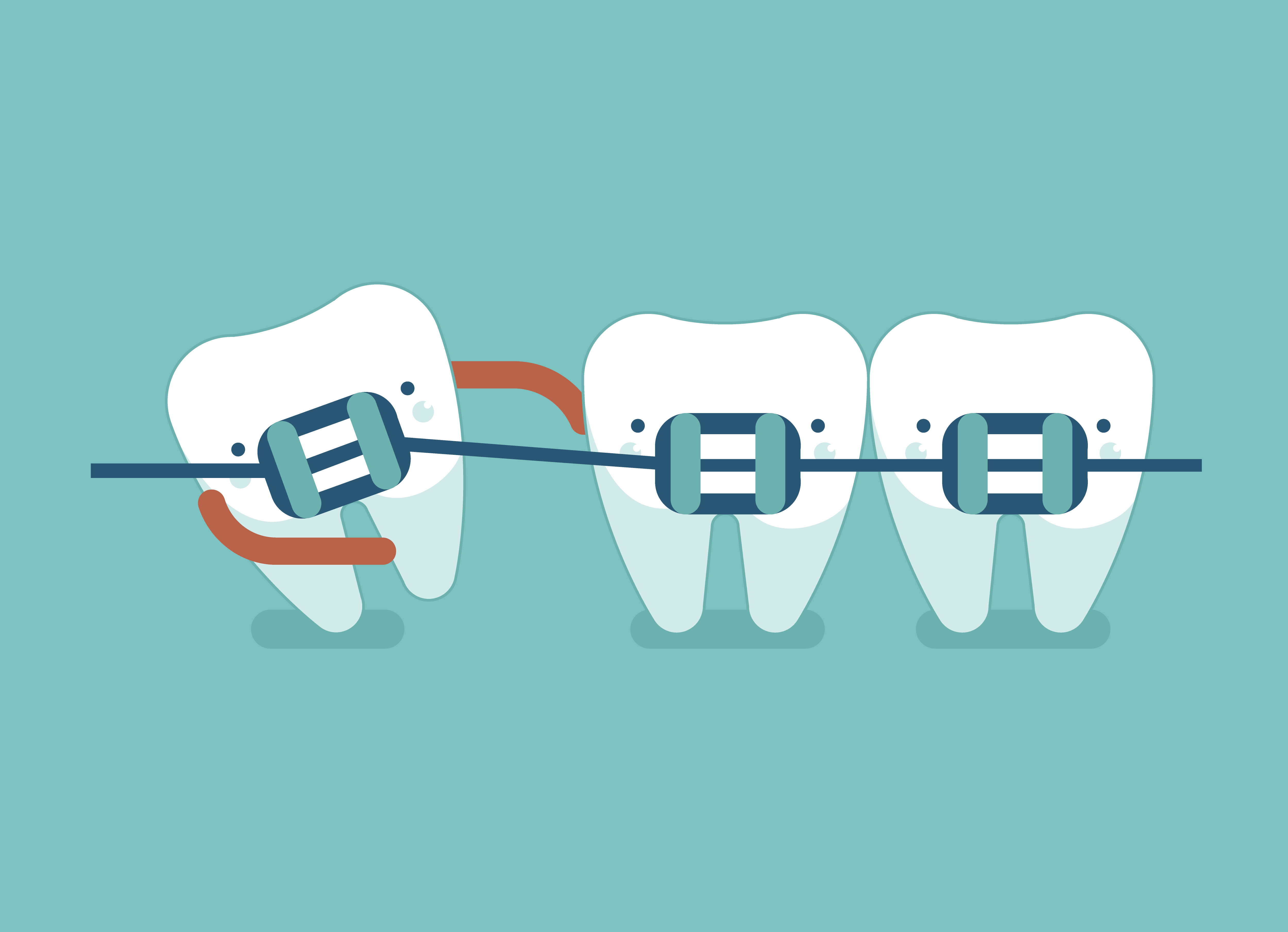 Reduce Braces Discomfort Fast