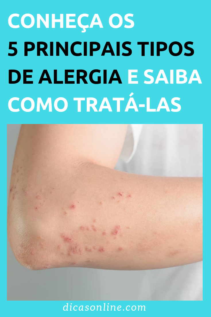 Remedio Para Alergia Na Pele